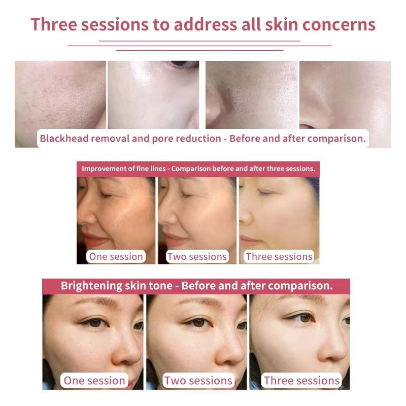 cell exosome cell exosome