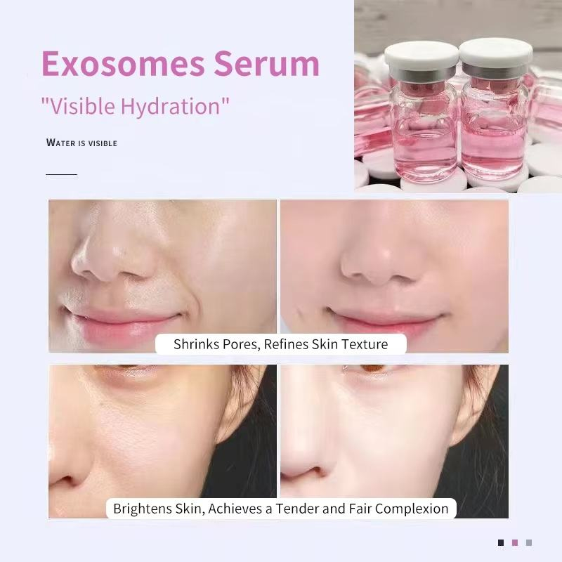 exosome serum exosome serum