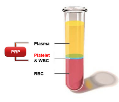 PRP introduction PRP introduction