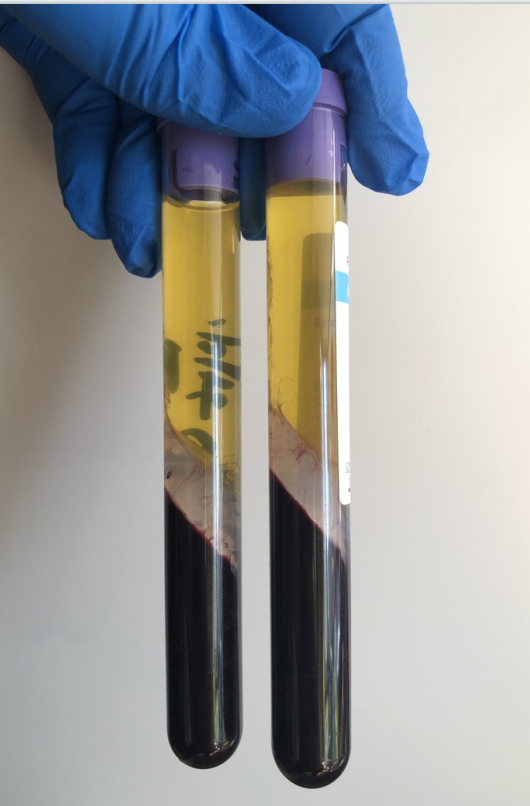 06 PRP tubes 06 PRP tubes