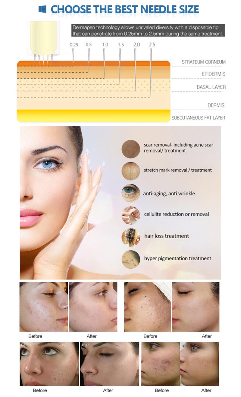 microneedle dermapen