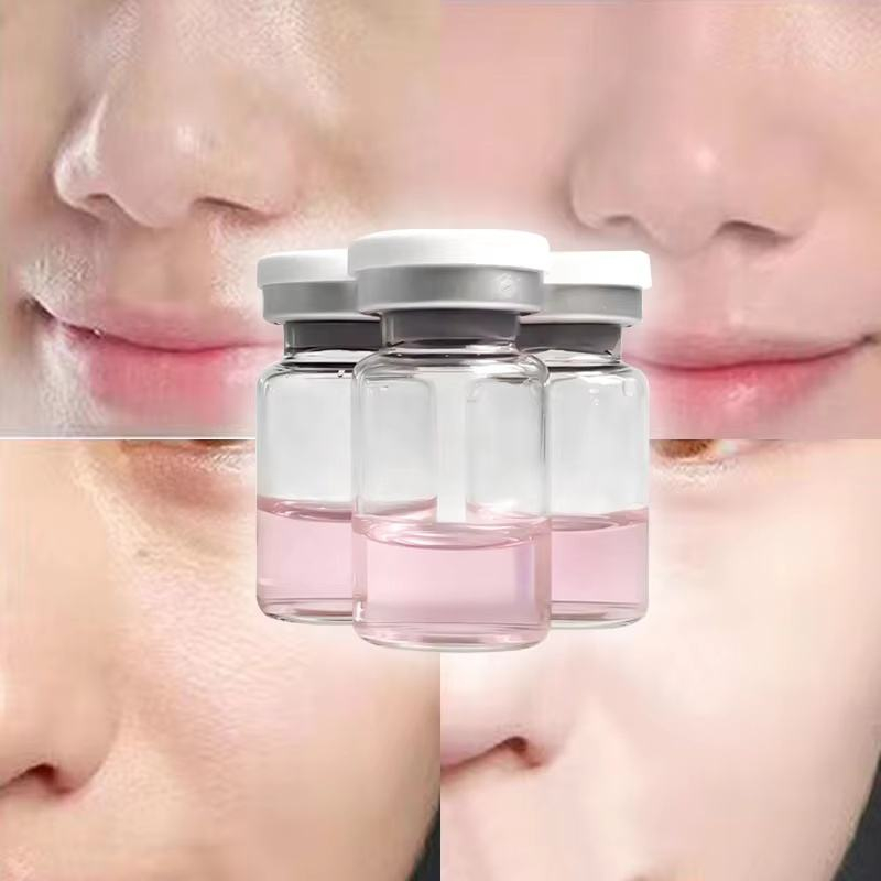 Exosomes Serum