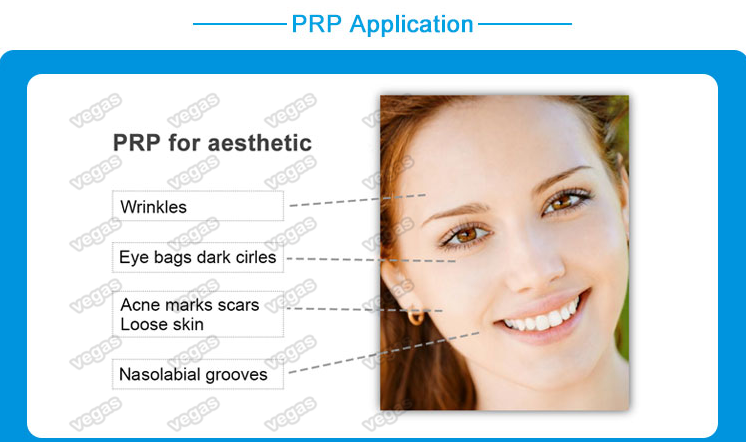 PRP application
