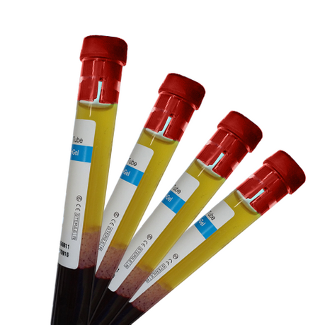PRP Tubes